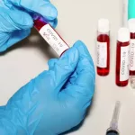 What to Know About the New COVID-19 Variant XFG What to Know About the New COVID-19 Variant XFG