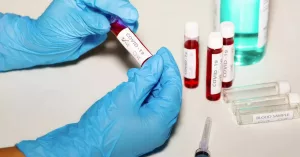 What to Know About the New COVID-19 Variant XFG