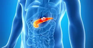 AI Revolution in Pancreatic Cancer Detection