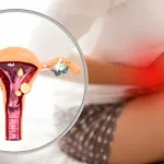 Are Nabothian Cysts Sexually Transmitted? Here’s the Truth