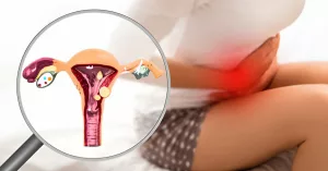 Are Nabothian Cysts Sexually Transmitted? Here’s the Truth