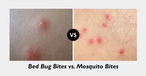 Bedbug Bites and Mosquito Bites: Spot the Signs, Stop the Itch Bedbug Bites and Mosquito Bites: Spot the Signs, Stop the Itch