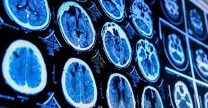 Biological Age Prediction – What You’re Missing Biological Age Prediction – What You’re Missing