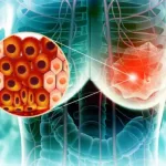 New Radiosering Could Make Breast Cancer Detection Quicker, More Undersyvel New Radiosering Could Make Breast Cancer Detection Quicker, More Undersyvel