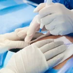 C-Section Cancer Risk: What Science Reveals C-Section Cancer Risk: What Science Reveals