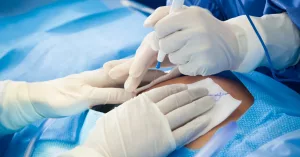 C-Section Cancer Risk: What Science Reveals