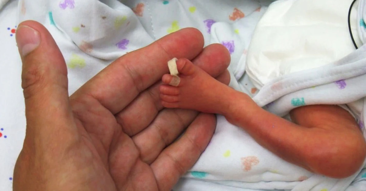 CMV Birth Defects: A Hidden Threat in Pregnancy