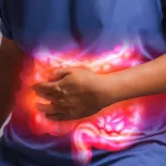 Why Young Adults Are Dying from Colon Cancer: A Silent Epidemic (And How to Stop It)