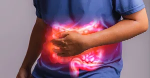 Why Young Adults Are Dying from Colon Cancer: A Silent Epidemic (And How to Stop It)