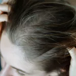 The Best Dry Scalp Shampoos to Soothe Your Itchy, Flaky Skin The Best Dry Scalp Shampoos to Soothe Your Itchy, Flaky Skin