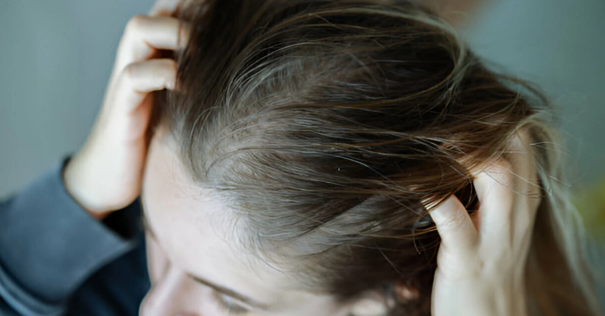 The Best Dry Scalp Shampoos to Soothe Your Itchy, Flaky Skin