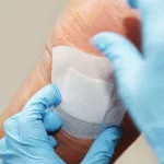 Intelligent Wound Dressings Stop Inflammation in Its Tracks