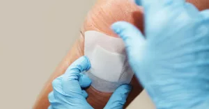 Intelligent Wound Dressings Stop Inflammation in Its Tracks