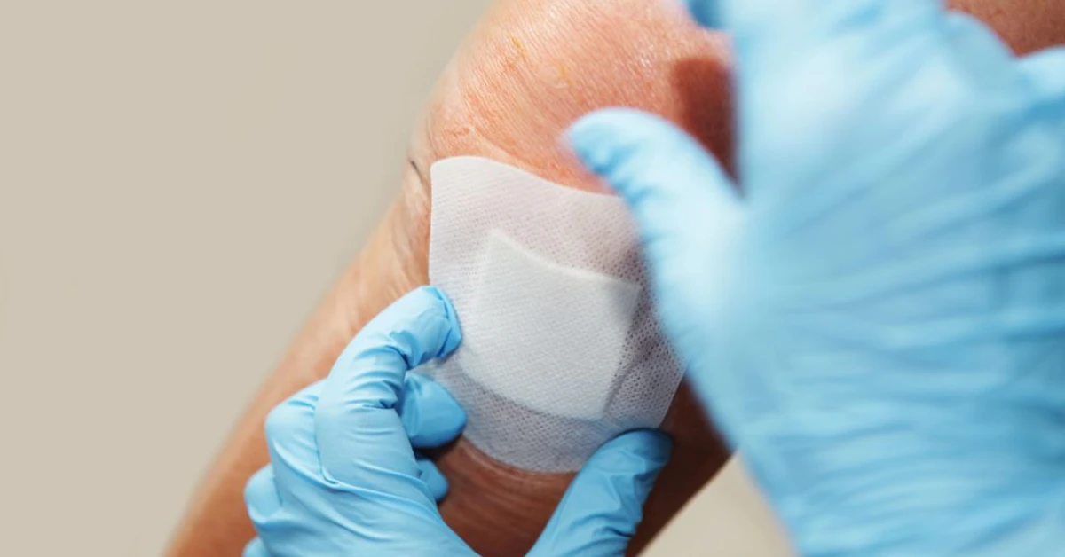 Intelligent Wound Dressings Stop Inflammation in Its Tracks