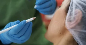 All About Jaw Fillers: How to Get a Chiseled Jaw Without Surgery