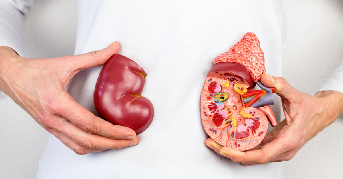 Kidney Transplant Cost – What You Need to Know