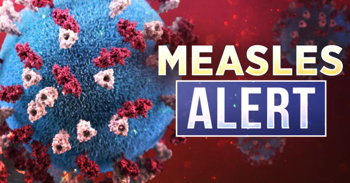 Confirmed Case of Measles in Upstate SC – What This Means for All of Us