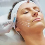 PDO Threads for Marionette Lines: What You Need to Know