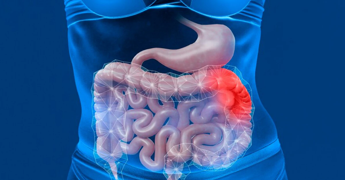 Common Bacteria Linked to 12M Stomach Cancer Cases