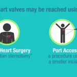 Choosing the Right Replacement Heart Valve: Your Guide Choosing the Right Replacement Heart Valve: Your Guide