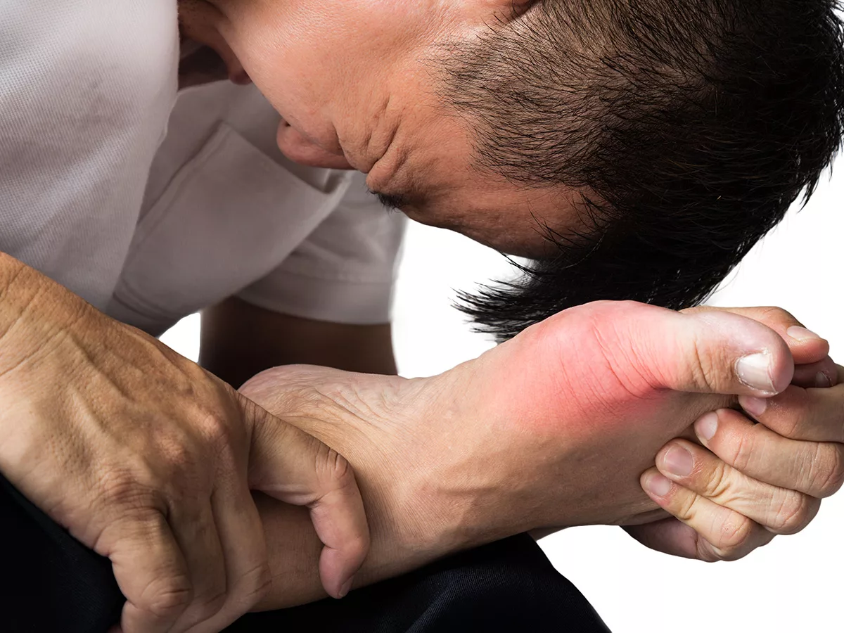Gout and CPPD: Risks, Symptoms, and Treatment