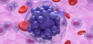 Essential Relapsed Lymphoma Drugs: Your Hopeful Guide