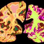 Alzheimer’s Treatment Alternatives: Natural Paths to Hope Alzheimer’s Treatment Alternatives: Natural Paths to Hope