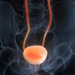 Predict & Prevent Bladder Cancer Recurrence Now Predict & Prevent Bladder Cancer Recurrence Now