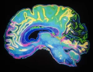 Brain Neuroimaging: Revealing the Brain’s Hidden Maps