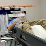 How Brain Scan Diagnosis Revolutionizes Dementia Care