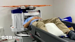 How Brain Scan Diagnosis Revolutionizes Dementia Care