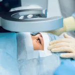 Understanding Cataract Surgery Outcomes: What to Expect Understanding Cataract Surgery Outcomes: What to Expect