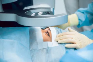 Understanding Cataract Surgery Outcomes: What to Expect