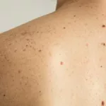 Genetic Skin Condition: What It Is, Symptoms & Treatment Genetic Skin Condition: What It Is, Symptoms & Treatment