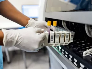 Parkinson’s disease blood test: What’s real today?