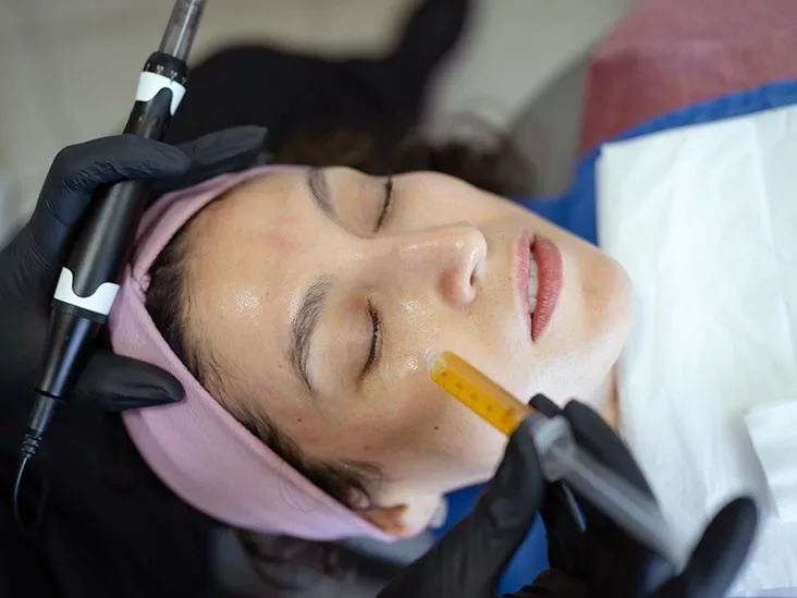 Salmon Sperm Facial: What It Is & Why It Matters
