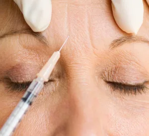 How Many People Get Botox? Stats, Cost, Safety & What It Means for You