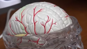 Progressive Apraxia of Speech: Essential Guide