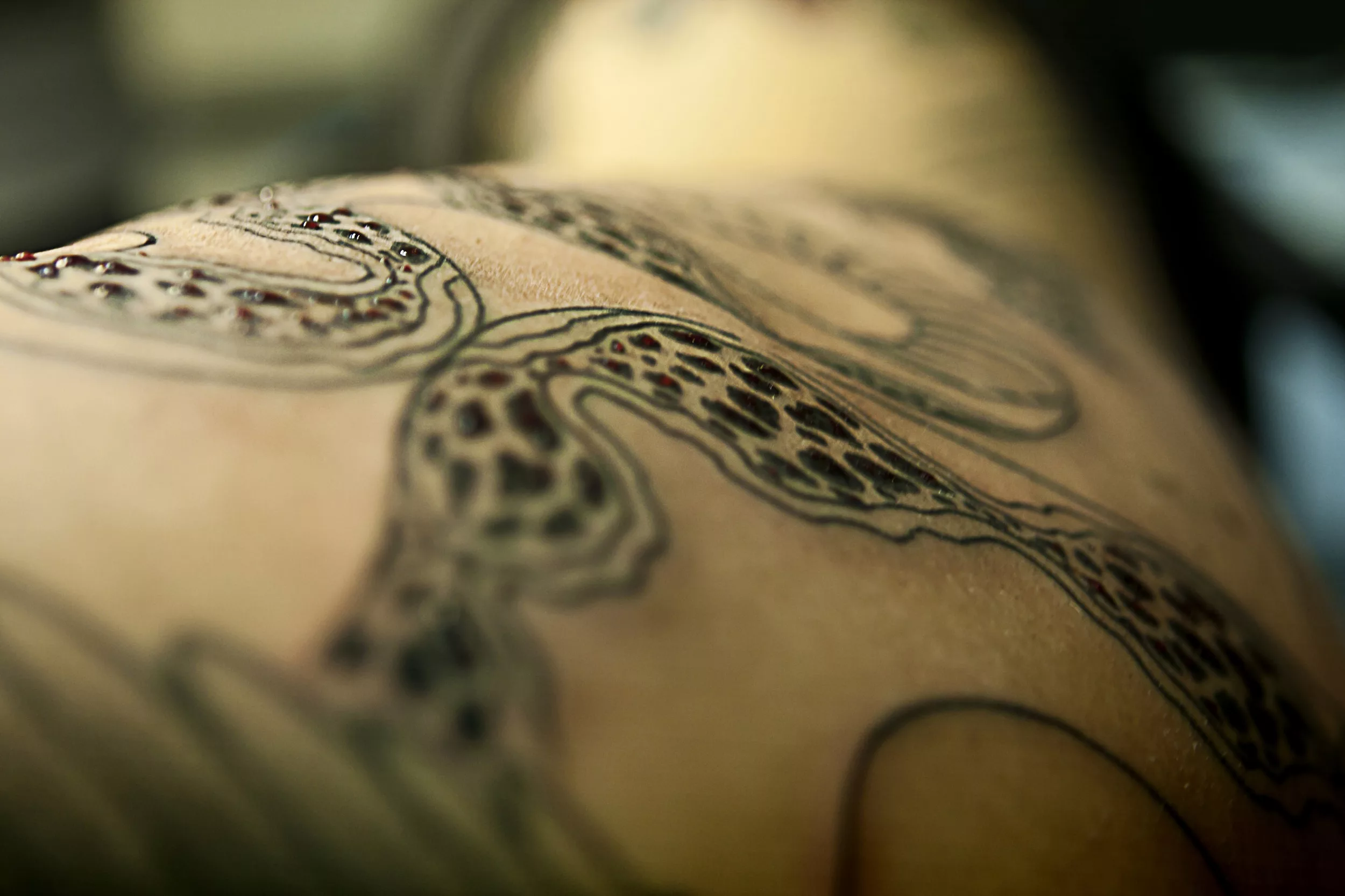 What Does Tattoo Scarring Look Like? A Friendly Guide