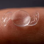 Intraocular Lens Stability — What Every Patient Should Know