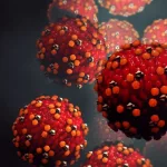 Measles Risks: What You Need to Know to Stay Safe Measles Risks: What You Need to Know to Stay Safe