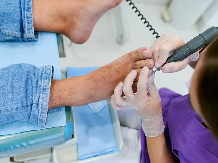 Medical Pedicure: What It Is, Who Needs It, and Why It Matters