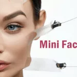 Mini Facelift: What You Need to Know Mini Facelift: What You Need to Know