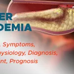 Mixed Hyperlipidemia Meaning: What It Is & How to Manage