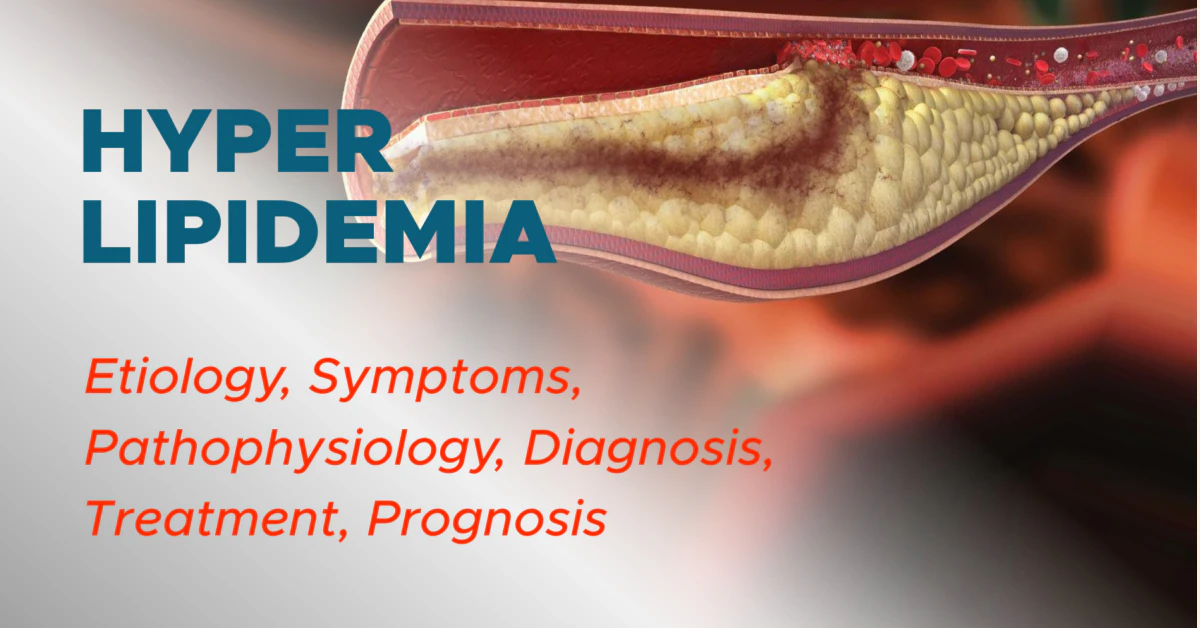 Mixed Hyperlipidemia Meaning: What It Is & How to Manage