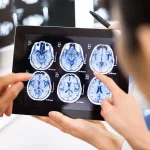 Neuroimaging Techniques Explained: How Brain Scans Work Neuroimaging Techniques Explained: How Brain Scans Work