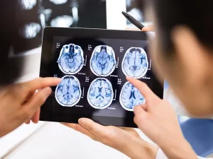 Neuroimaging Techniques Explained: How Brain Scans Work