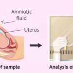 Non‑invasive early diagnosis: painless cancer testing Non‑invasive early diagnosis: painless cancer testing