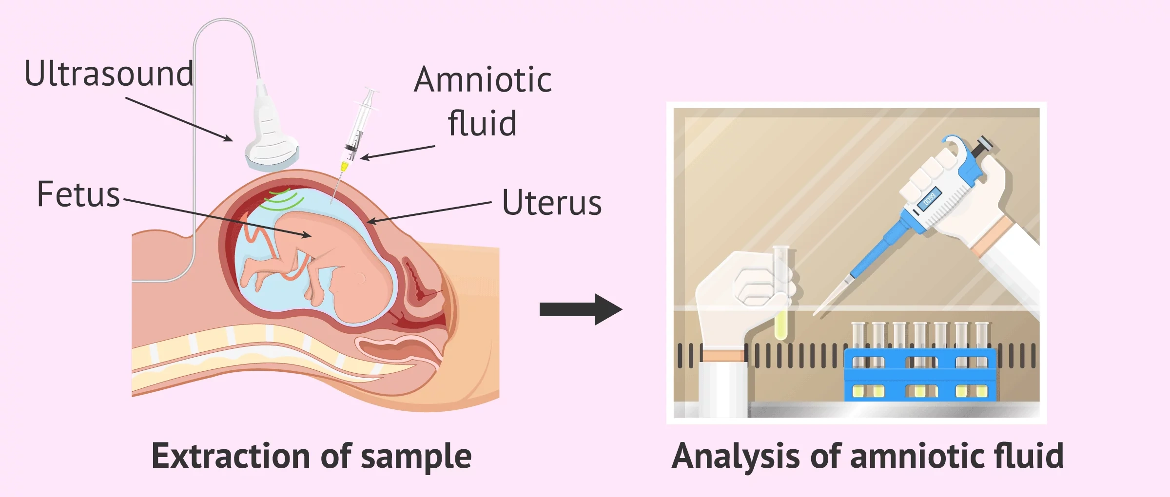 Non‑invasive early diagnosis: painless cancer testing