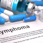 Refractory Lymphoma Therapy: Hopeful Options Guide